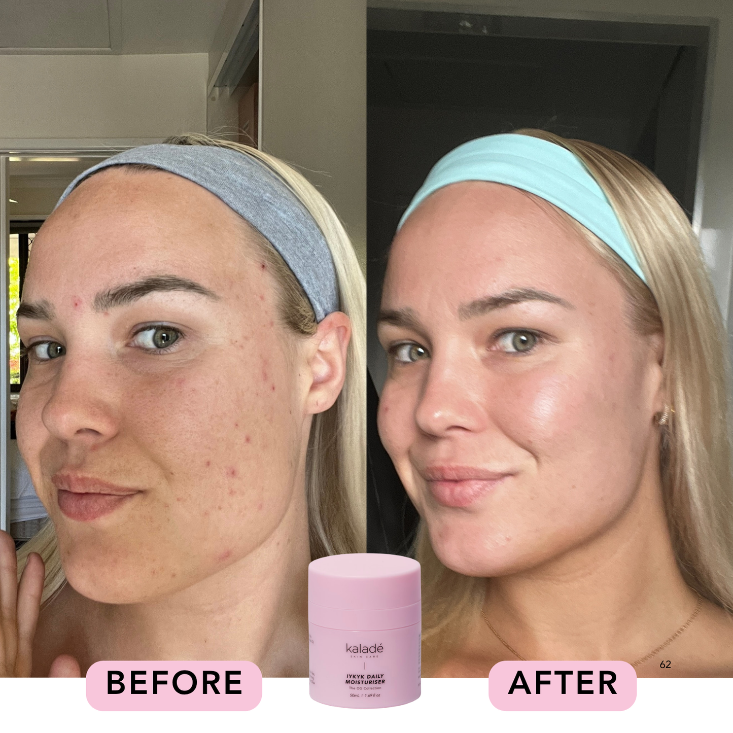 IYKYK Daily Moisturiser