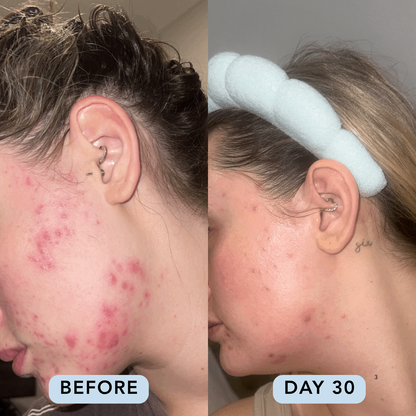 Essential Four Skincare Routine
