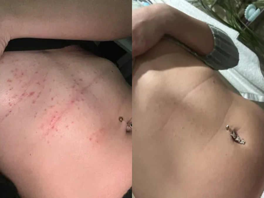 DAY 30