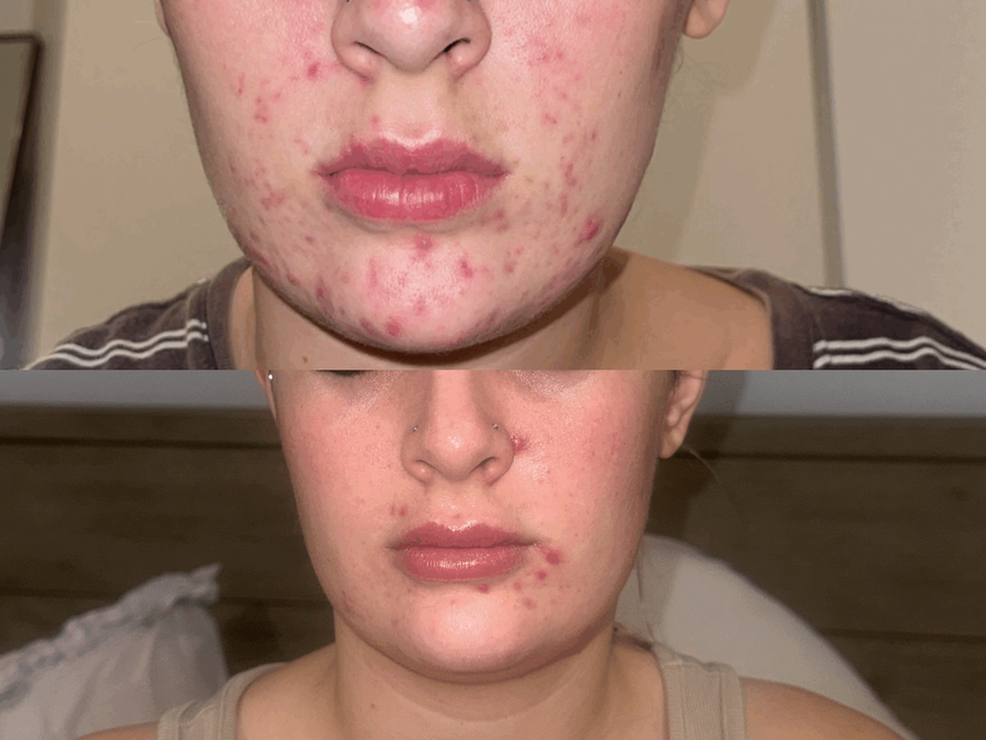 Day 30