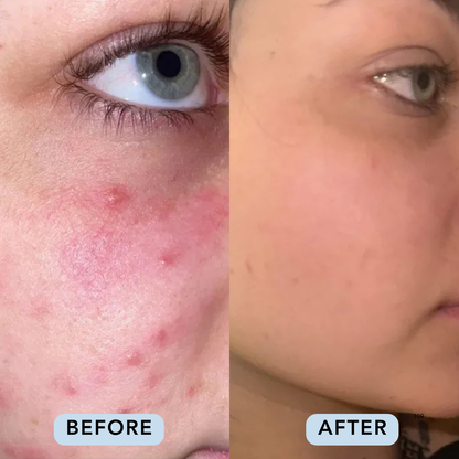 Essential Four Skincare Routine