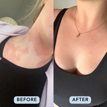 Essential Four Skincare Routine