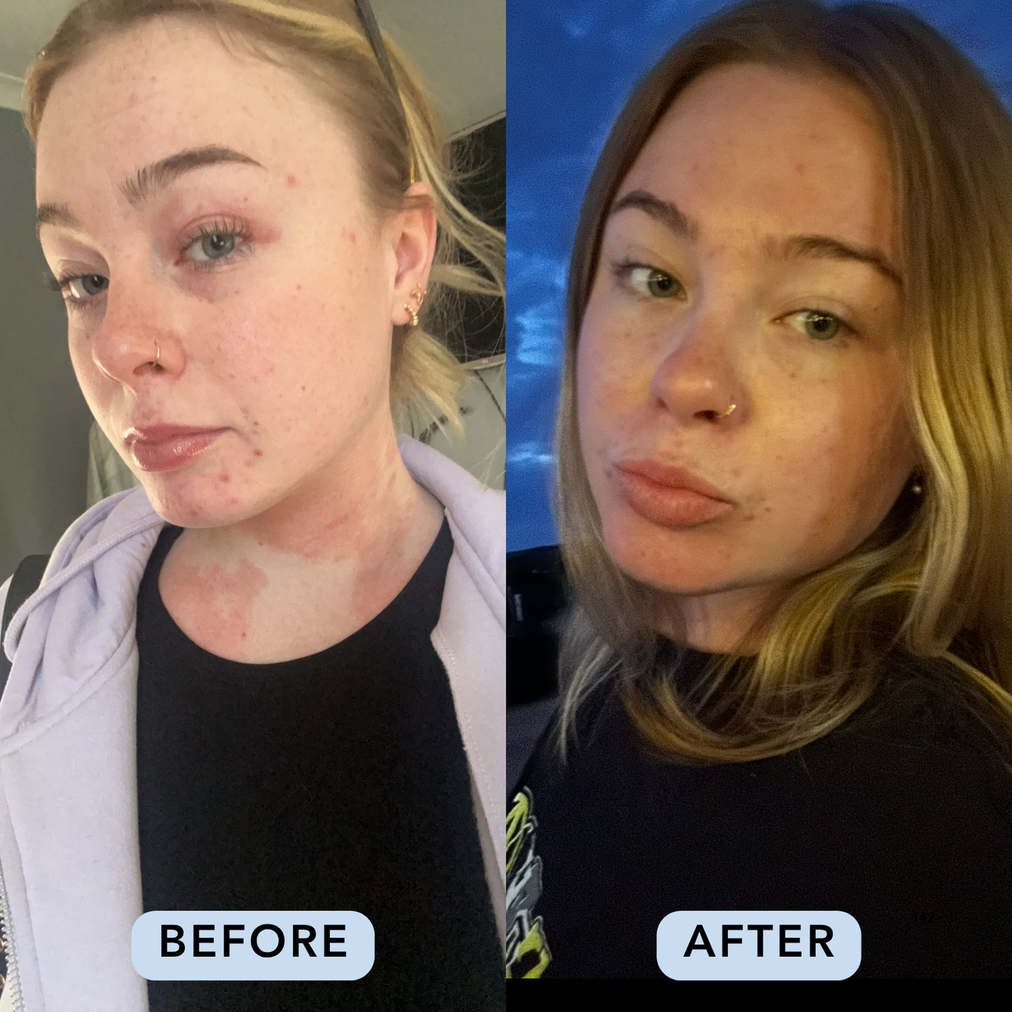Essential Four Skincare Routine