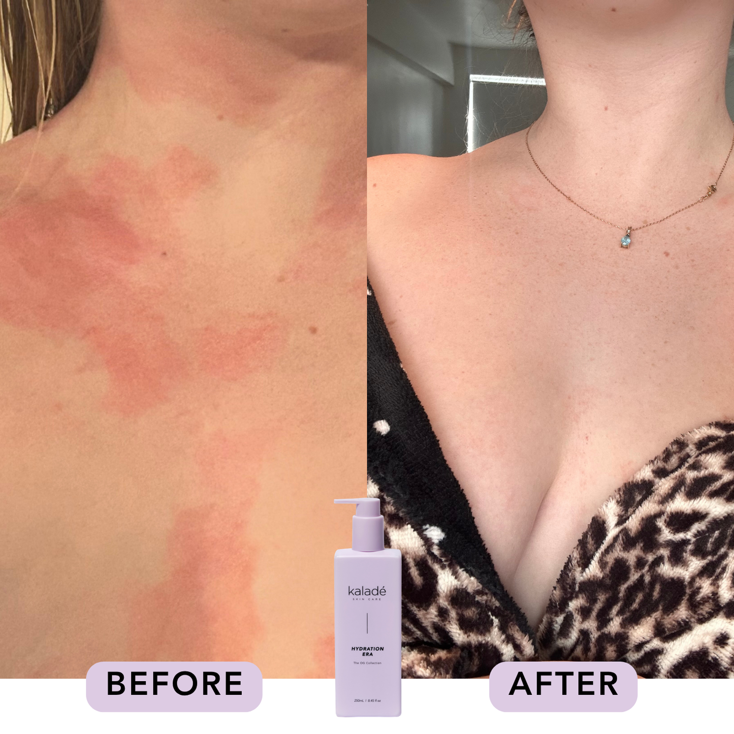 Hydration Era Body Lotion