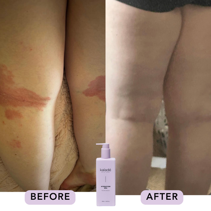 Hydration Era Body Lotion