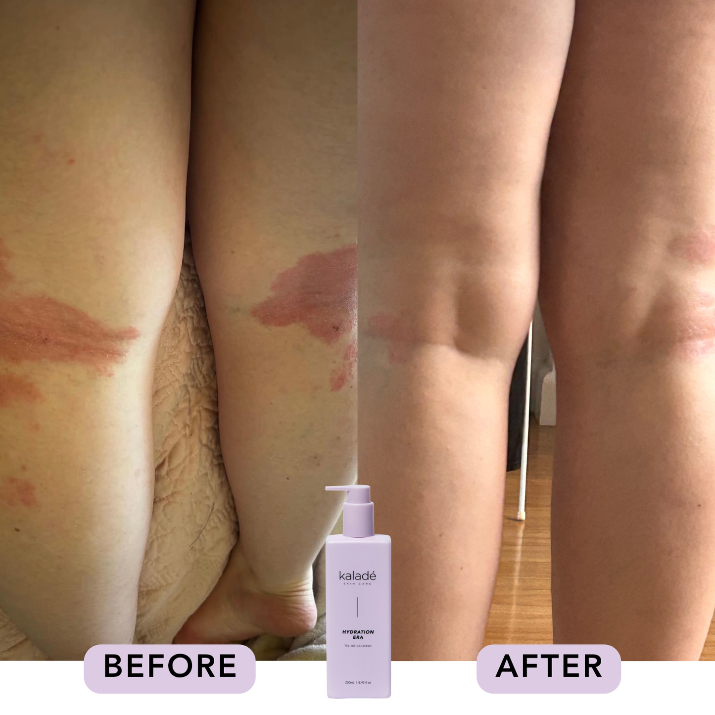 Hydration Era Body Lotion