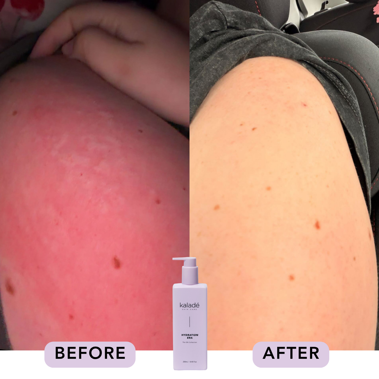 Hydration Era Body Lotion