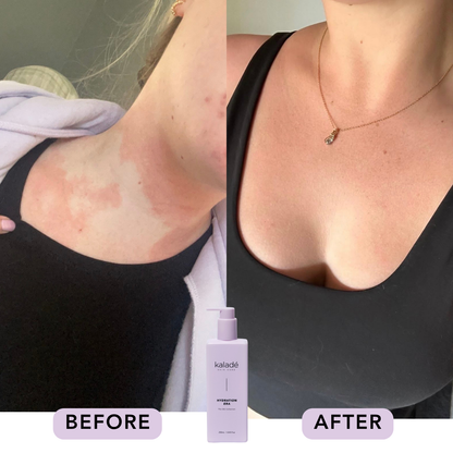 Hydration Era Body Lotion