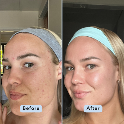 Glow & Refresh Bundle