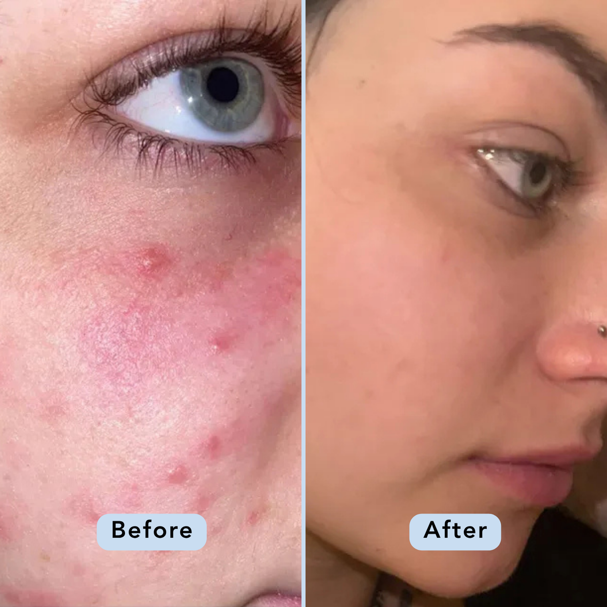 Glow & Refresh Bundle