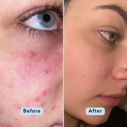 Glow & Refresh Bundle